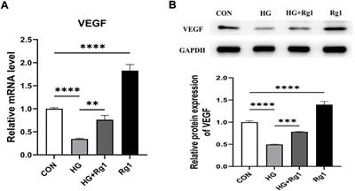 Ginsenoside Rg1 interferes with the progression of diabetic osteoporosis by promoting type H angiogenesis modulating vasculogenic and osteogenic coupling